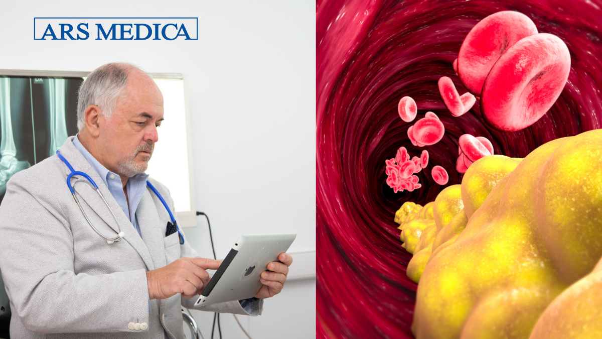 dislipidemia cause