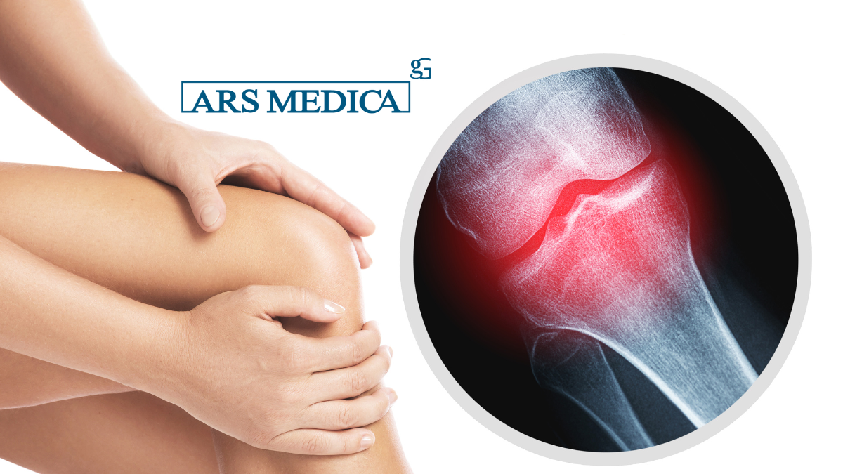 osteoporosi terapia