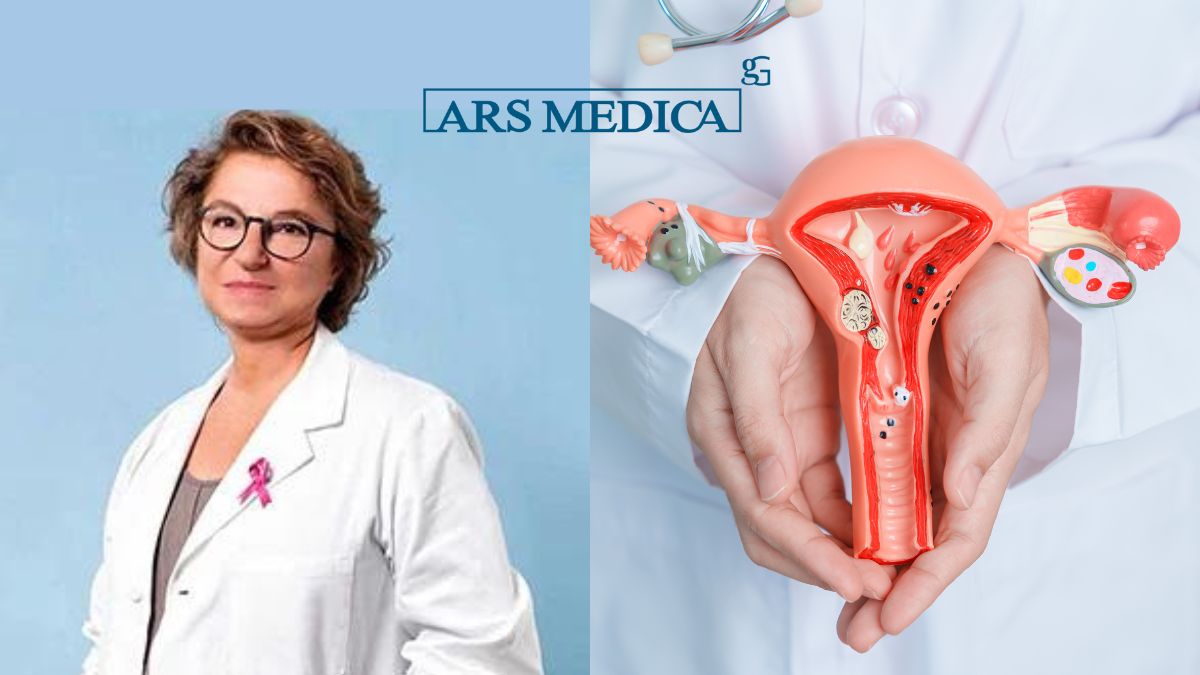 fibromi uterini cura