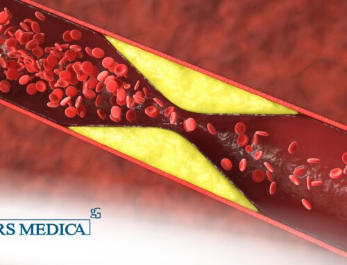 Differenza tra colesterolo ldl e hdl: tutto quello che c’è da sapere