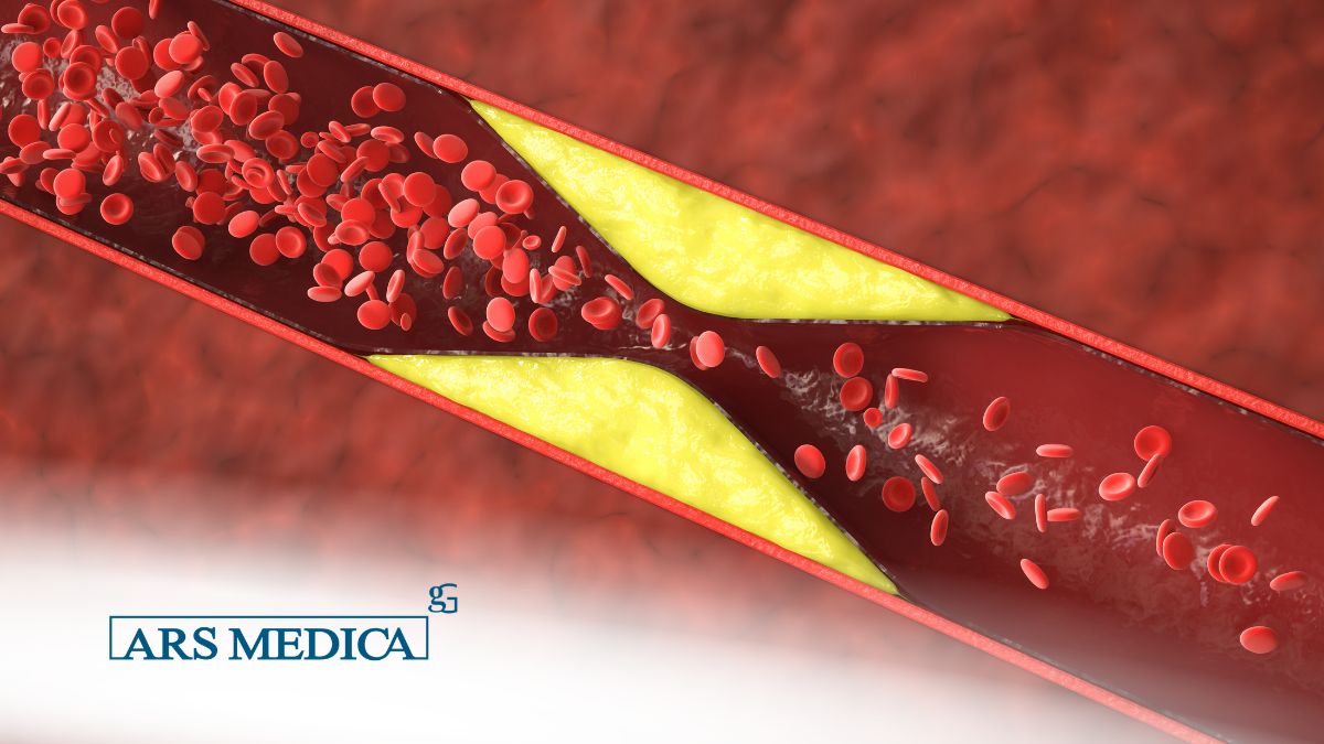 differenza tra colesterolo ldl e hdl