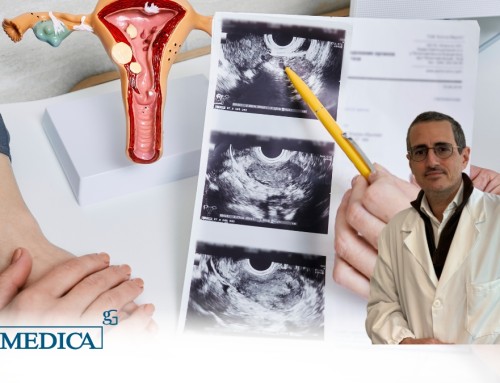Isteroscopia diagnostica a Roma: è dolorosa? Perchè è fondamentale per la prevenzione?