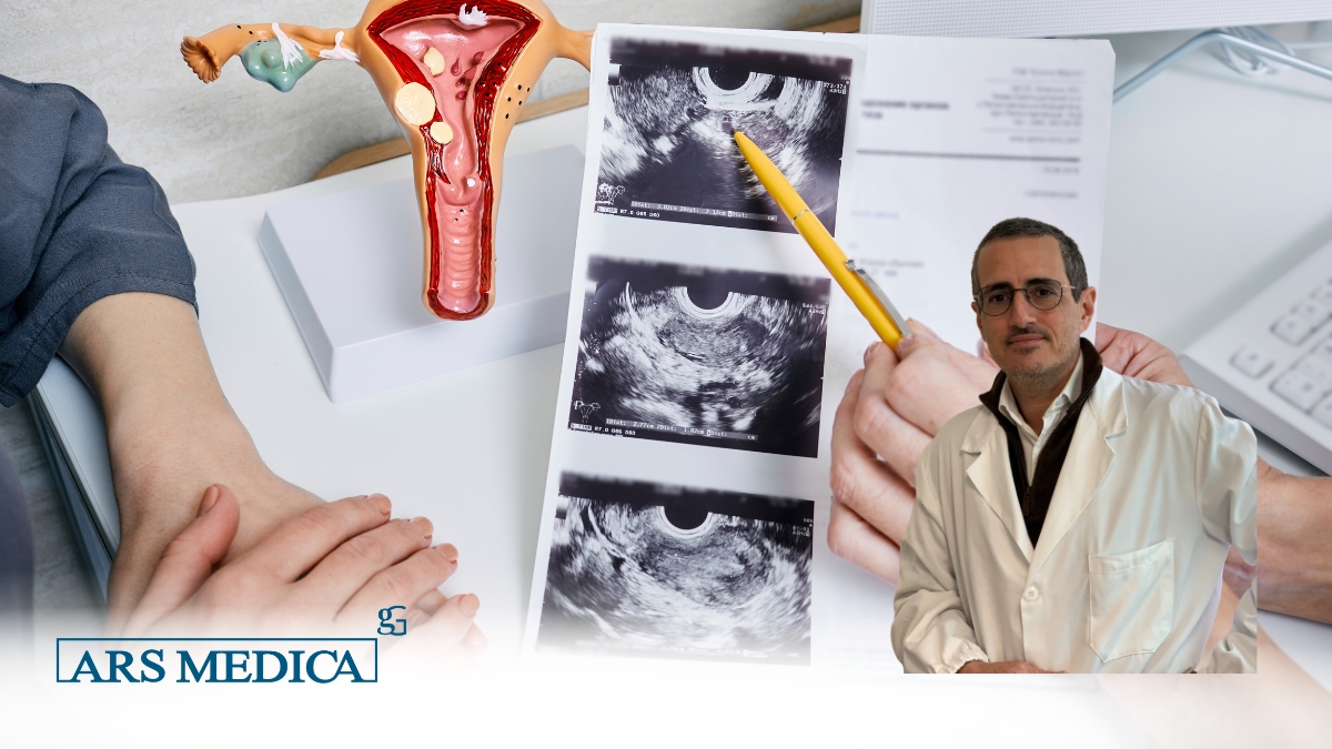 Isteroscopia diagnostica roma