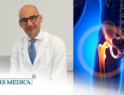 Protesi d’anca: i benefici della tecnica Resurfacing